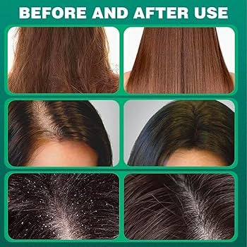 Ussman Herbal Shampoo Bar – Cypress Leaf